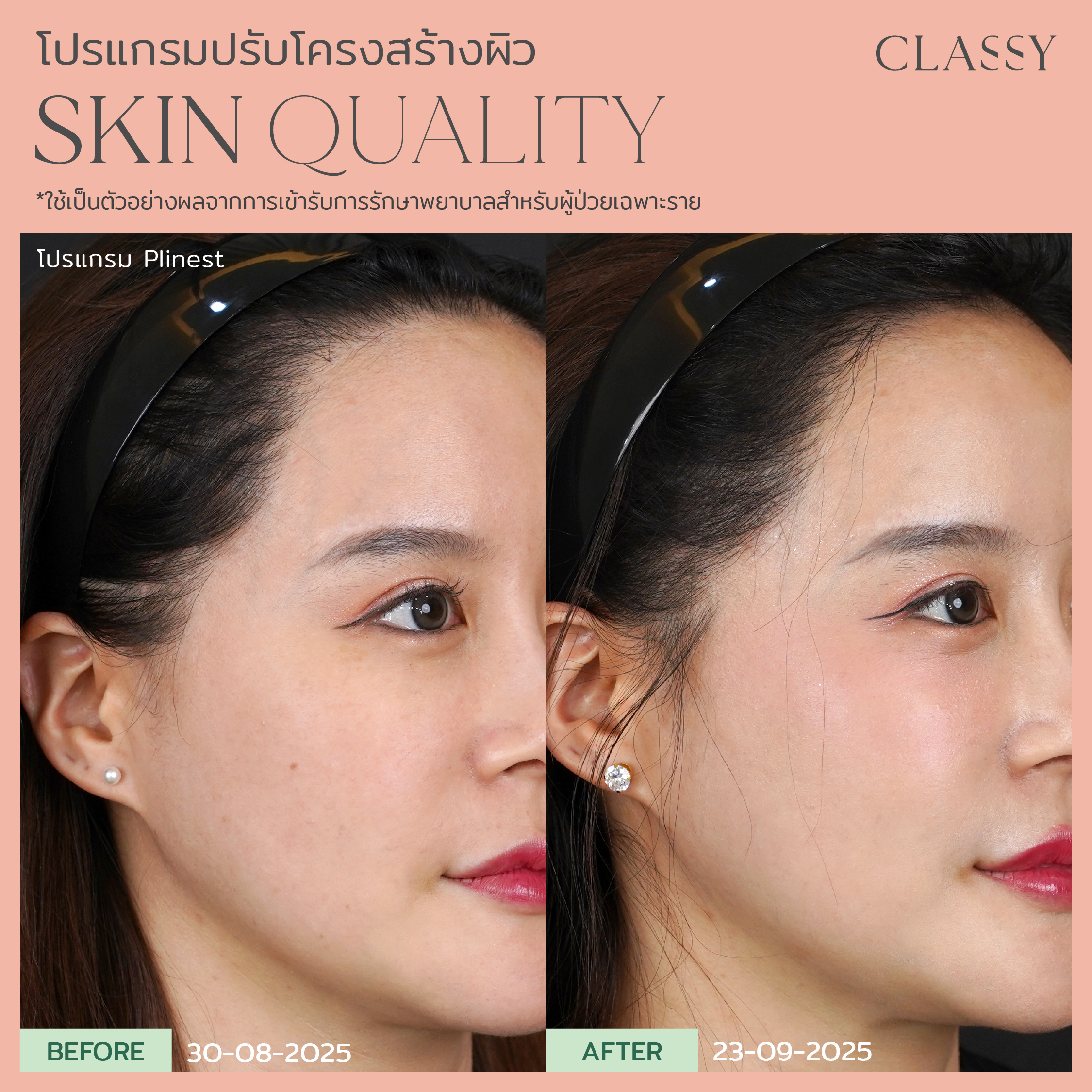 BA SKIN QUALITY-15