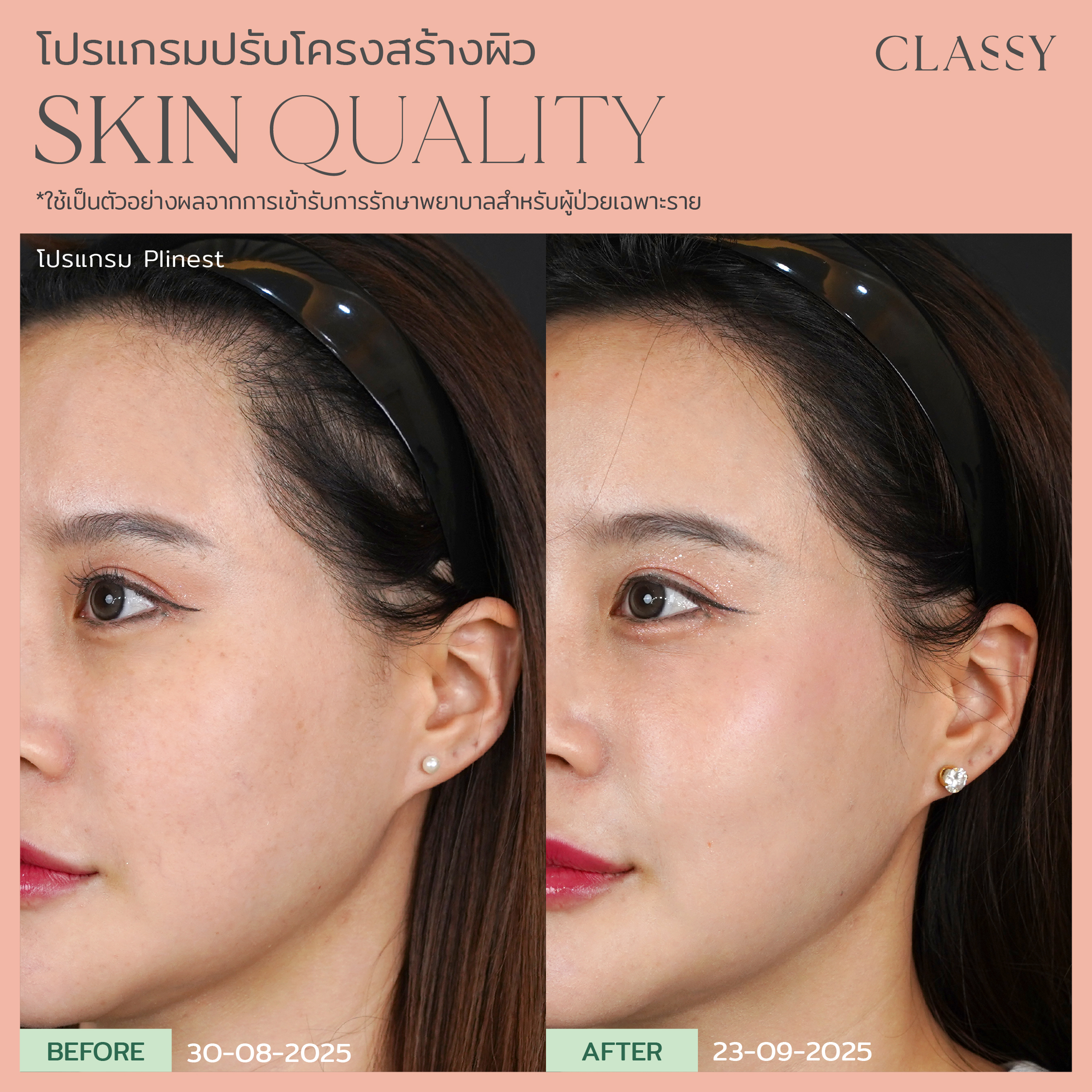 BA SKIN QUALITY-16