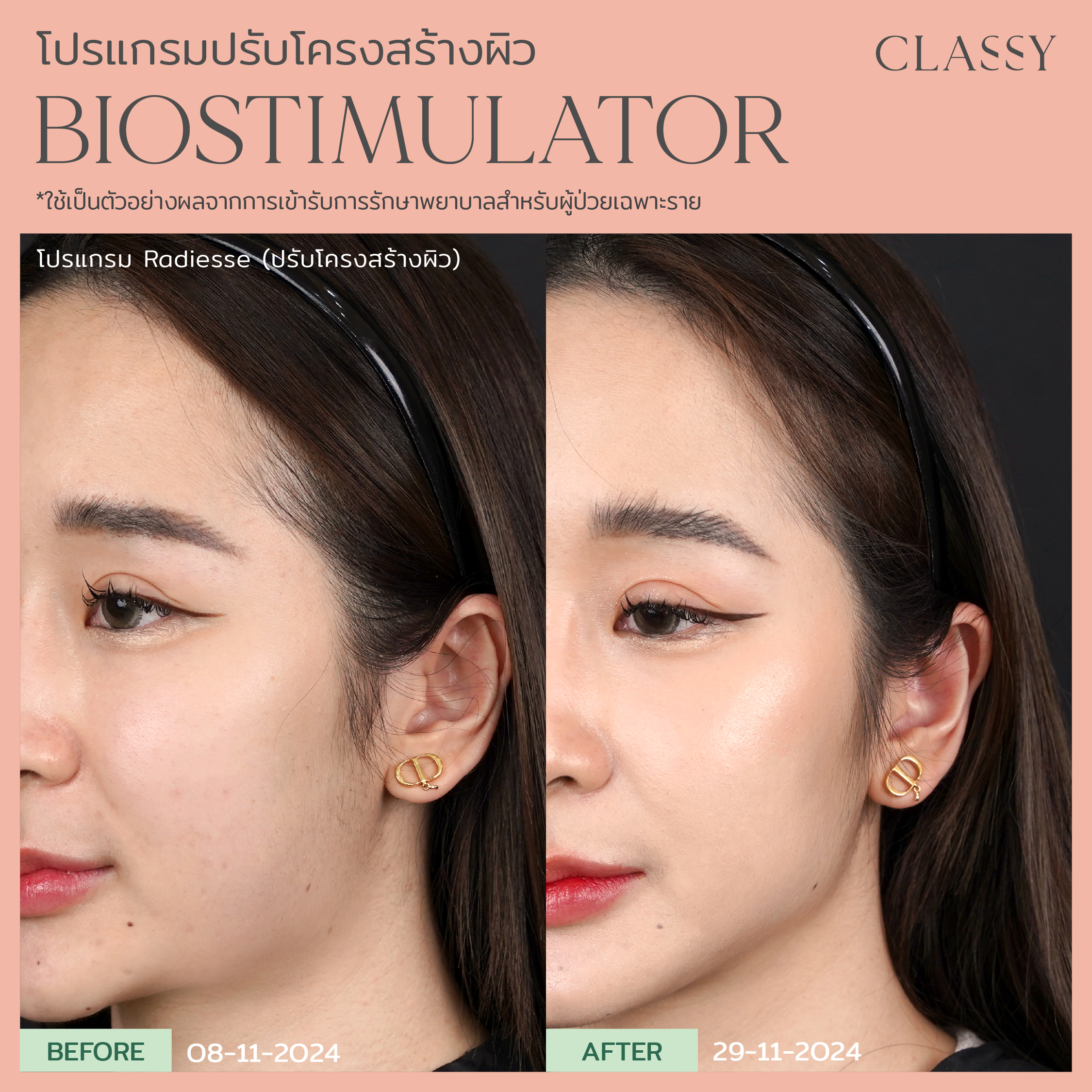 แตงกวา-15