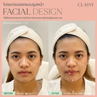 BA FACIAL DESIGN-06 1
