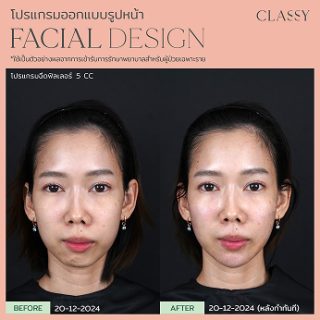 BA FACIAL DESIGN-06 2