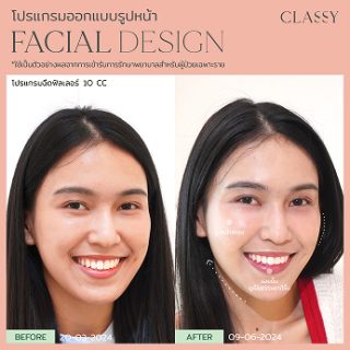 BA FACIAL DESIGN-06
