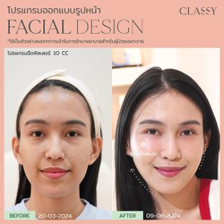 BA FACIAL DESIGN-14