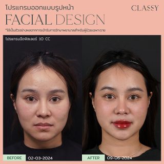 BA FACIAL DESIGN-15 1