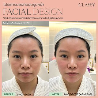BA FACIAL DESIGN-16