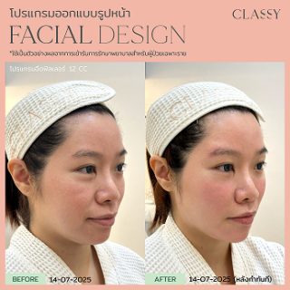 BA FACIAL DESIGN-17