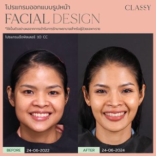BA FACIAL DESIGN-20 1
