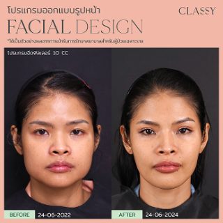 BA FACIAL DESIGN-21 1