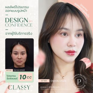 BA design confi - filler ปรับรูปหน้า-02