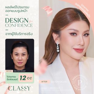 BA design confi - filler ปรับรูปหน้า-03