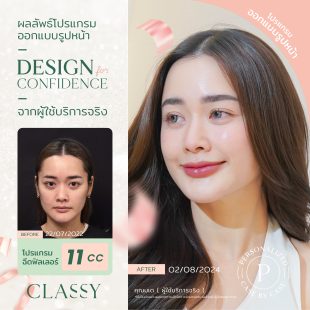 BA design confi - filler ปรับรูปหน้า-09